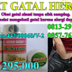 Illustration for article titled Cara mengatasi selangkangan gatal saat hamil